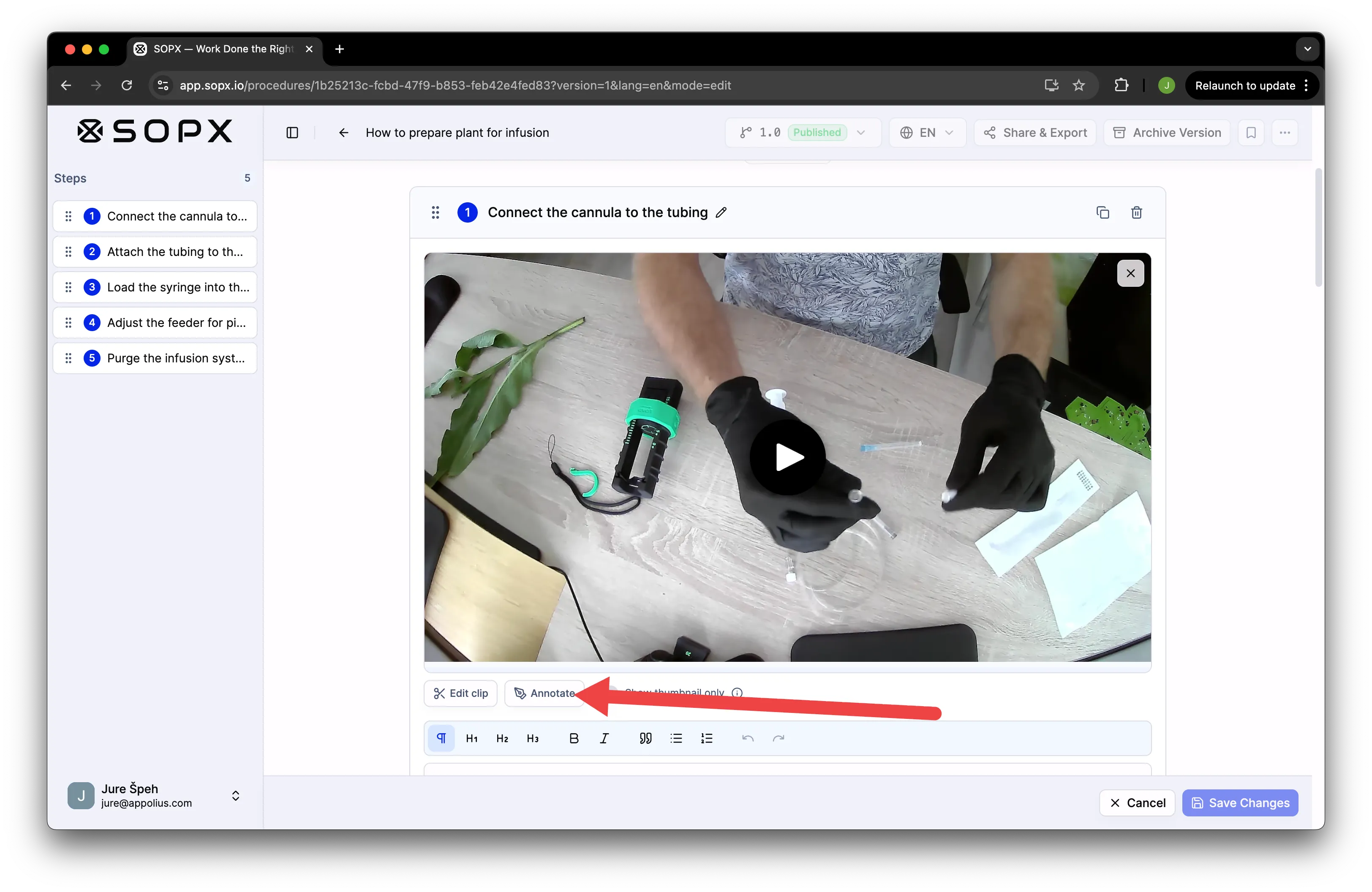 The Annotate button on an SOP step in SOPX