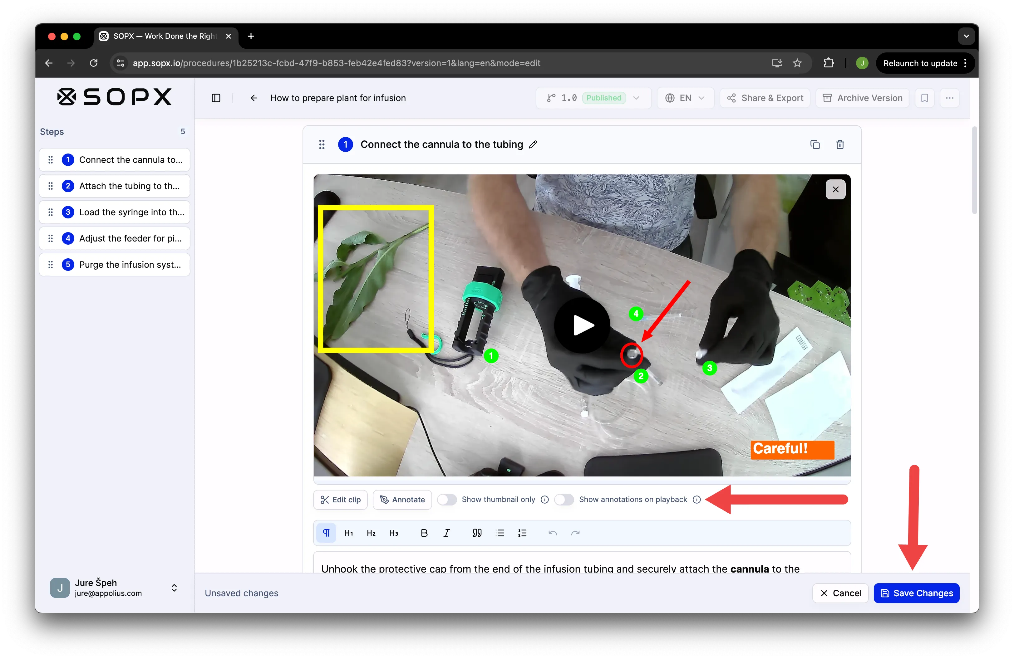 Toggle for showing annotations on the video and the Save changes button in SOPX