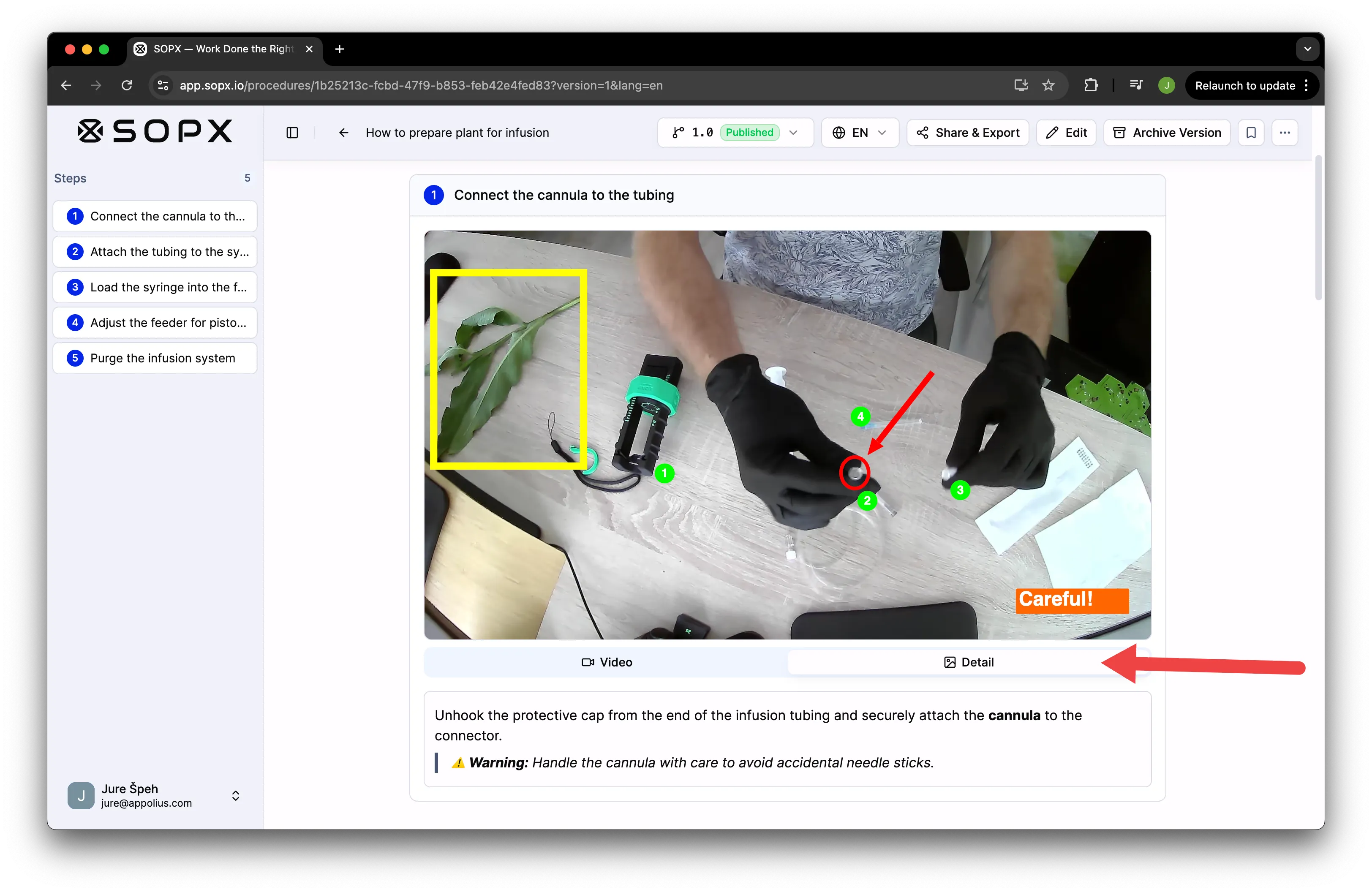 Detail view showing the annotated key frame in SOPX